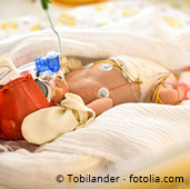 Premature infant in incubator