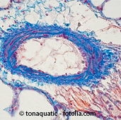 Mikroskopaufnahme einer menschlichen Lungenzelle