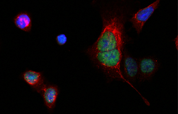 Lung slice with epithelial cells (red), nucleus (blue) and markers for cell ageing (green)