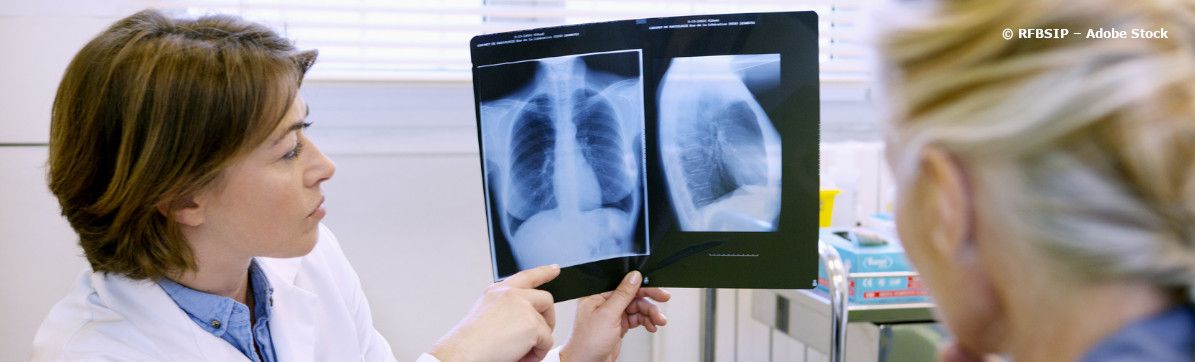 Forschung am CPC-M - Sich ein Bild von der Lunge machen